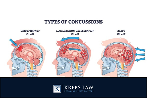 Injuries Cyclists Often Sustain